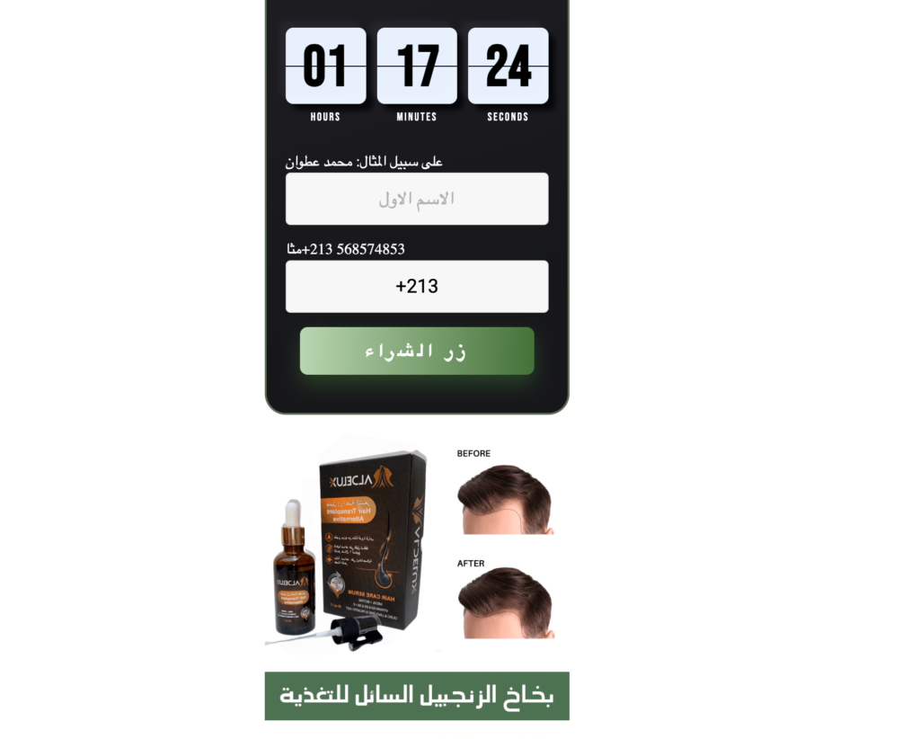 Aldelux  المراجعات